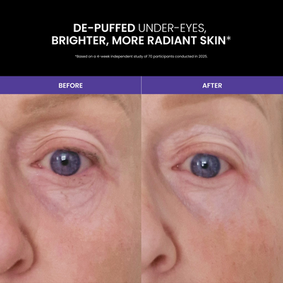 Lustre GoGlow LED Advanced Under Eye Patches